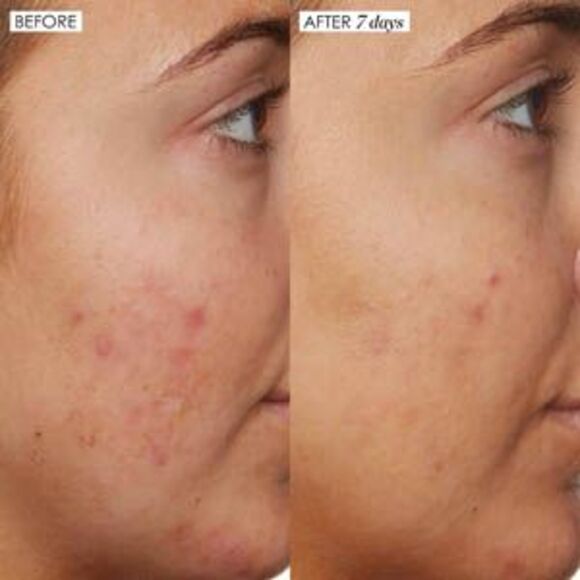 SUNDAY RILEY B3 Nice 10% Niacinamide Serum - Picture 3 of 3